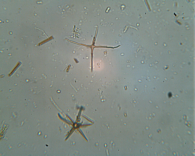 Asterostroma laxum Bres. (1920)